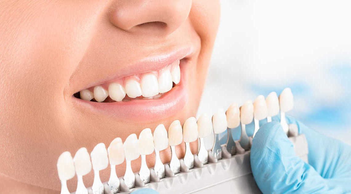 Cleveland cosmetic dentistry