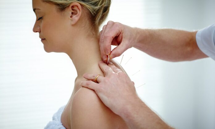 dry needling physio melbourne