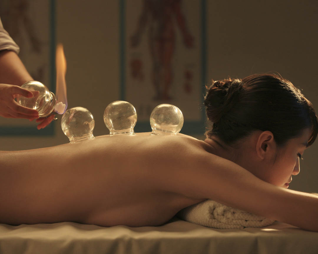 Cupping therapy melbourne