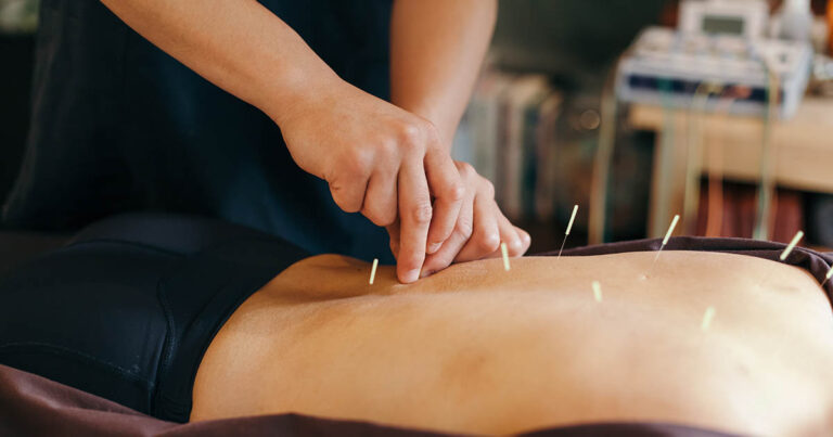 Remedial Massage Carlton